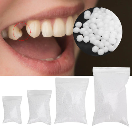 Temporary Tooth Repair Beads